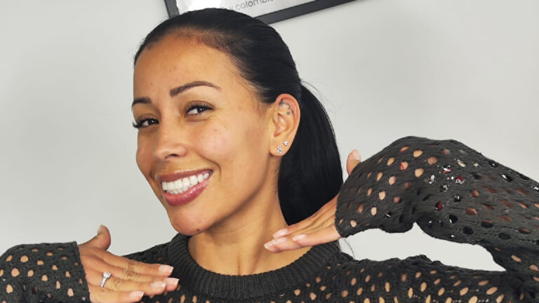 Lee más sobre el artículo Tipos de diseño: ¿Qué opciones tiene para transformar tu sonrisa?