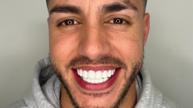 Lee más sobre el artículo El Impacto de la Salud Bucal en la Autoestima: Más Allá de la Estética