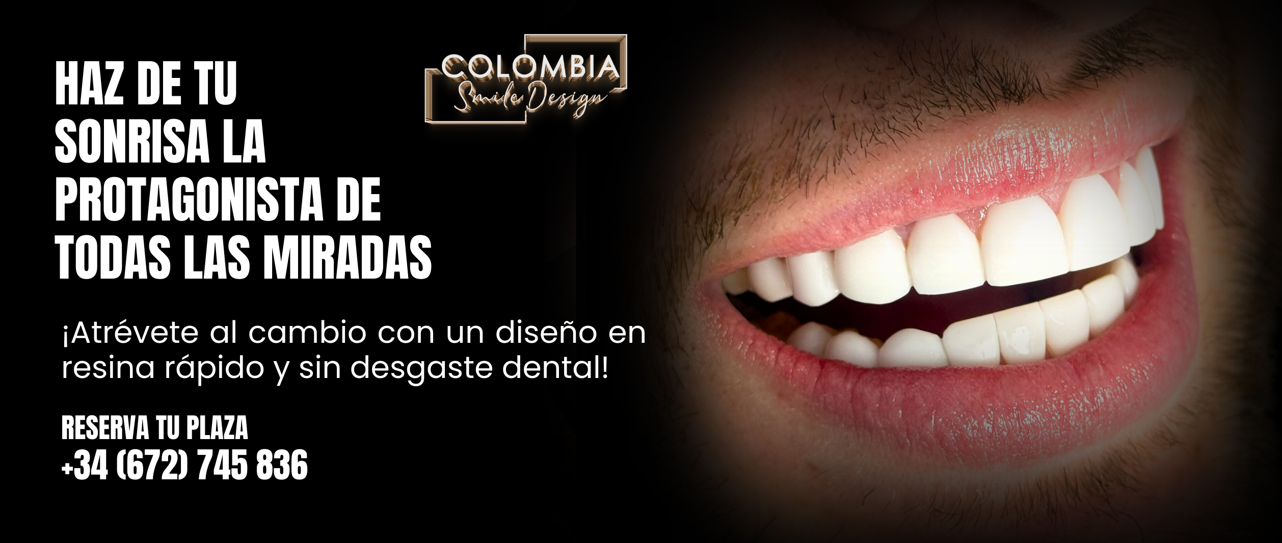 DISEÑO DE SONRISA ESPAÑA