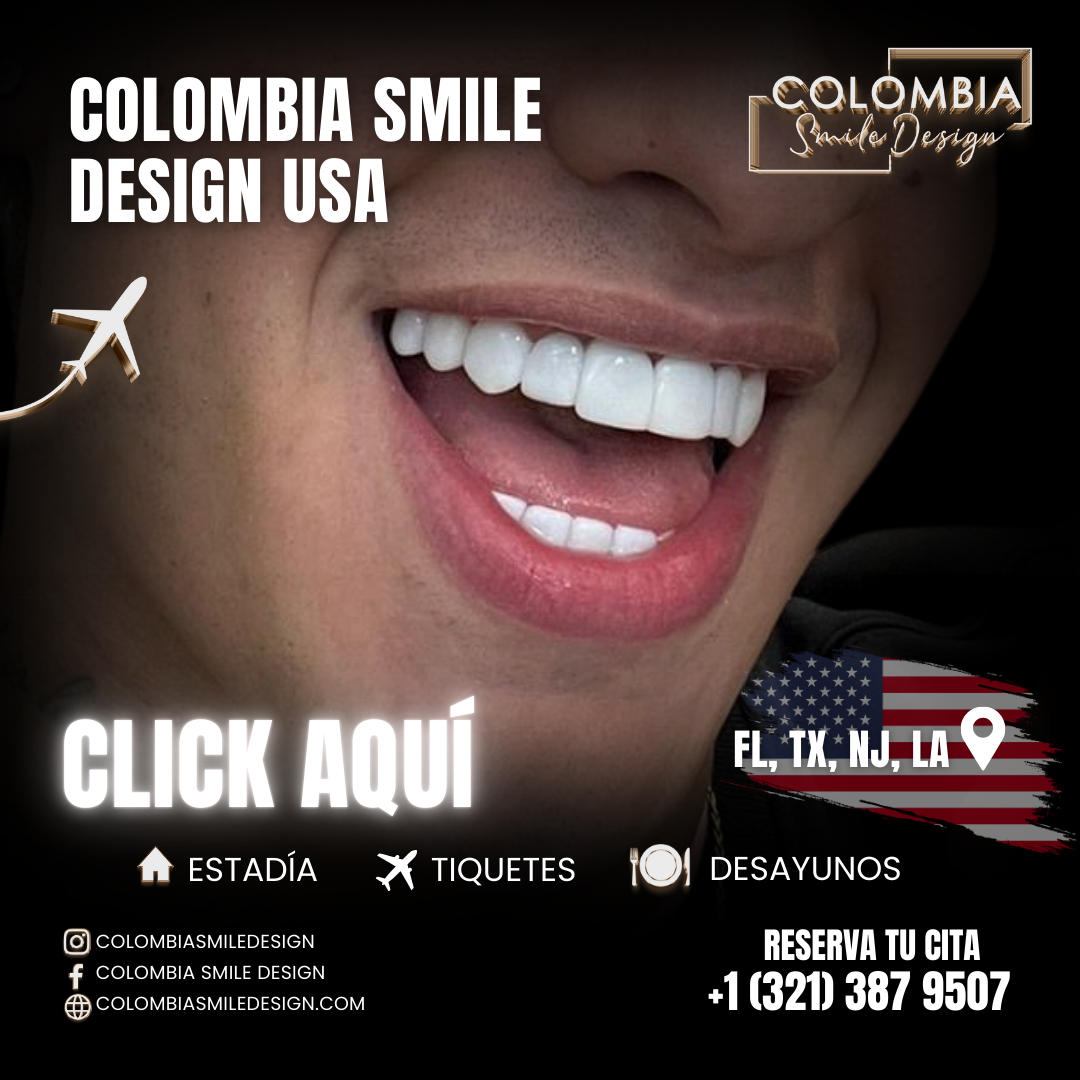 Diseño de sonrisa Estados Unidos